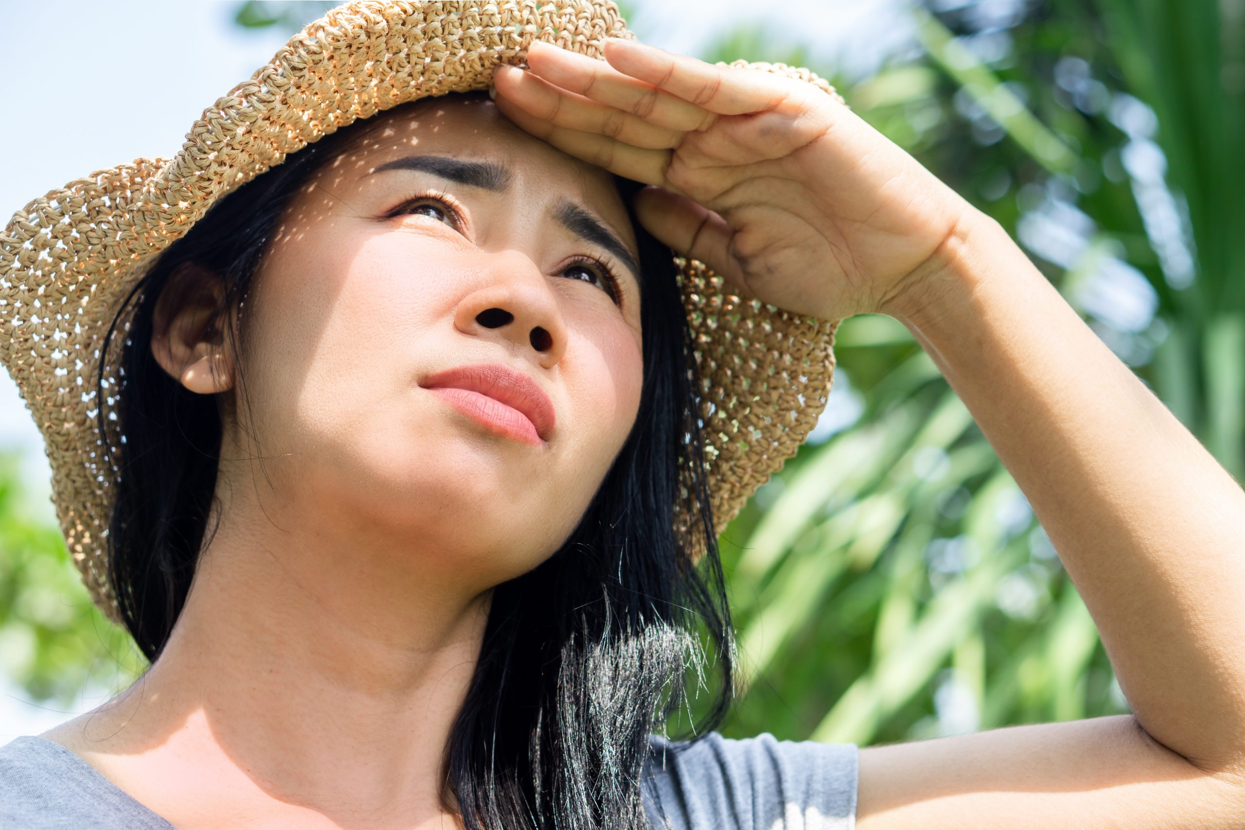 Schütze deine Kopfhaut und Lippen vor Sonnenbrand: Die besten Tipps